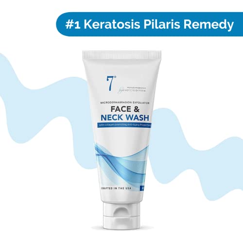 Microdermabrasion Keratosis Pilaris & Acne Exfoliating Deep Cleansing Face & Body Scrub